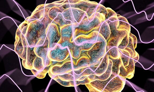 Brain with sound waves coming across it.